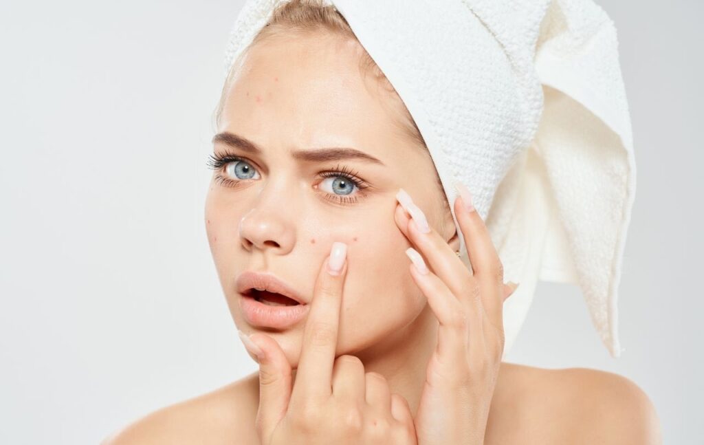 How A HydraFacial Treatment Can Be Used To Treat Acne?