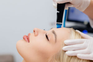 HydraFacial for Rosacea