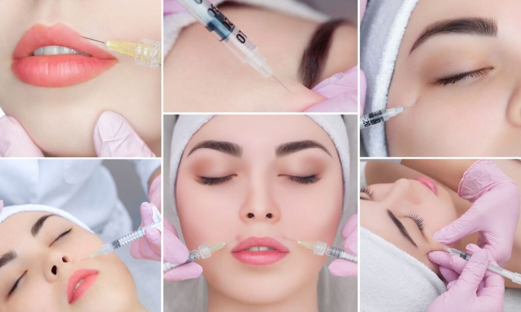 Side Effects of Dermal Fillers