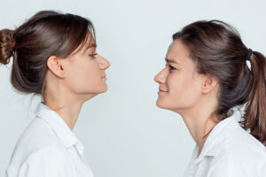 What Is Causing Your Double Chin