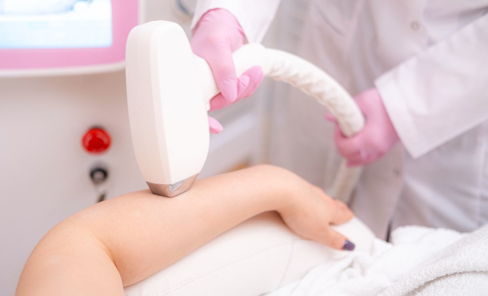 Why You May Not Be Getting Results From Laser Hair Removal