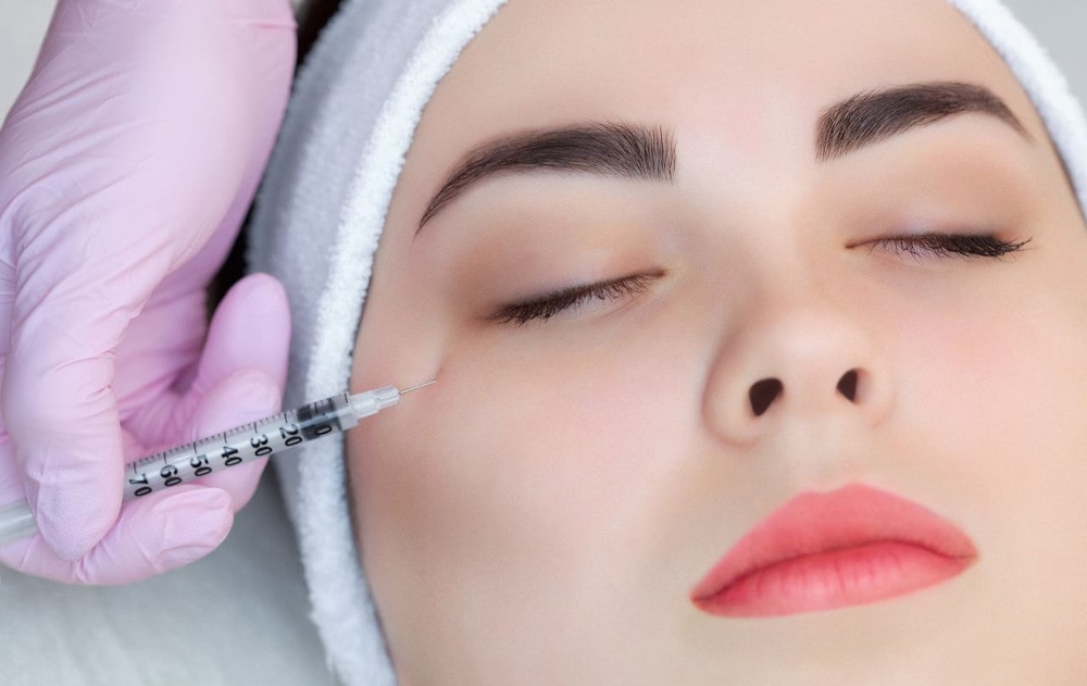 Benefits of Botox Microdosing