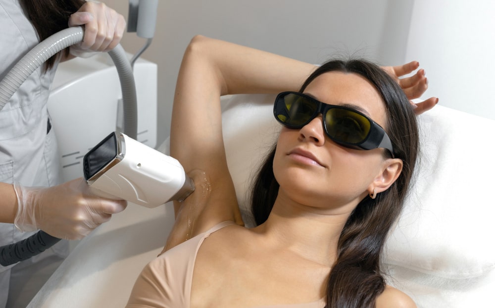 laser hair removal
