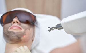 CO2 Laser vs Non-Ablative Lasers