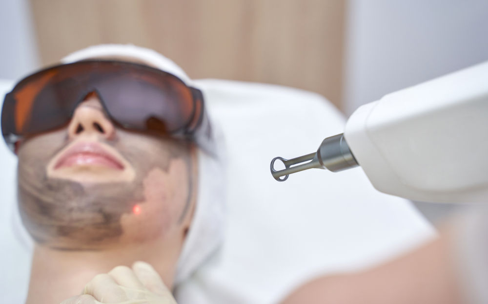 CO2 Laser vs Non-Ablative Lasers