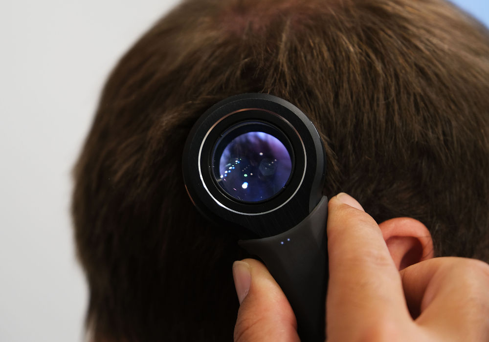 When Will You Start Seeing Results from PRP?