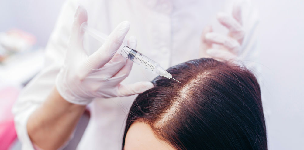 Who Is the Best Candidate for PRP Hair Restoration?