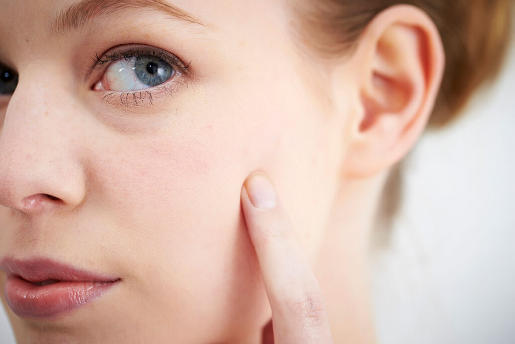 Which Treatment Is Best for Your Type of Pores?